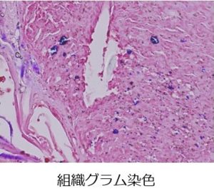 組織グラム染色